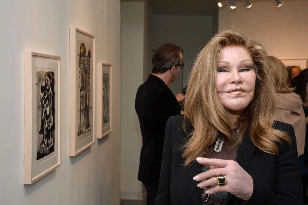 Jocelyn Wildenstein - KUBET