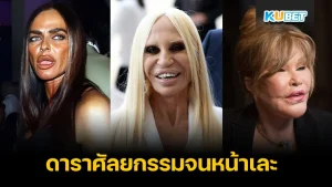 ดาราเสพติดศัลยกรรมจนใบหน้าผิดรูป - KUBET