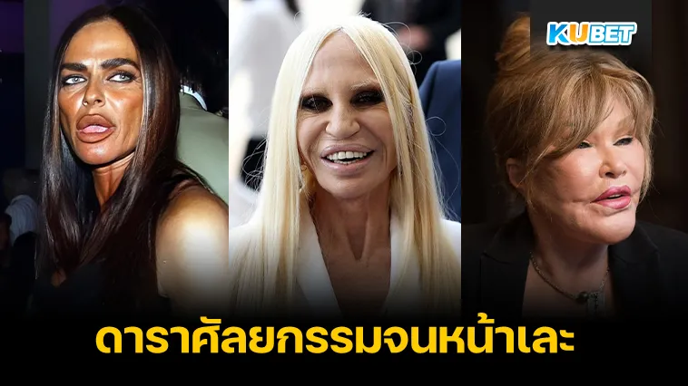 ดาราเสพติดศัลยกรรมจนใบหน้าผิดรูป – KUBET